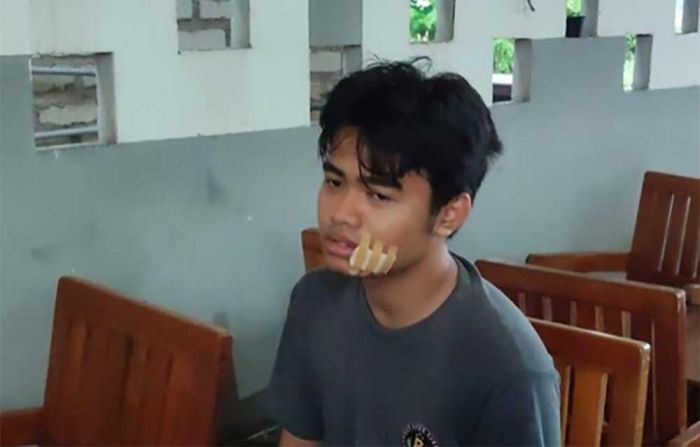 Mahasiswa UTM Jadi Korban Jebakan Benang Nilon saat Naik Motor di Jembatan Suramadu Mahasiswa UTM Jadi Korban Jebakan Benang Nilon saat Naik Motor di Jembatan Suramadu