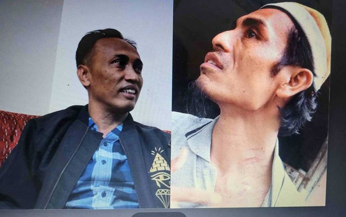 Kepala Pasar Kolpajung Bantah Aniaya, Korban Tunjukkan Luka Bekas Cakar Kepala Pasar Kolpajung Bantah Aniaya, Korban Tunjukkan Luka Bekas Cakar