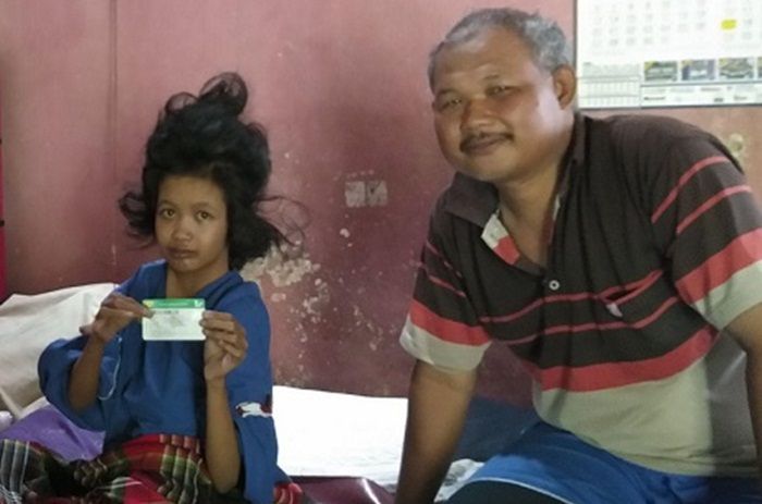 Rasakan Manfaatnya, Keluarga Penderita TOF di Madiun Berharap JKN-KIS Terus Ada Rasakan Manfaatnya, Keluarga Penderita TOF di Madiun Berharap JKN-KIS Terus Ada