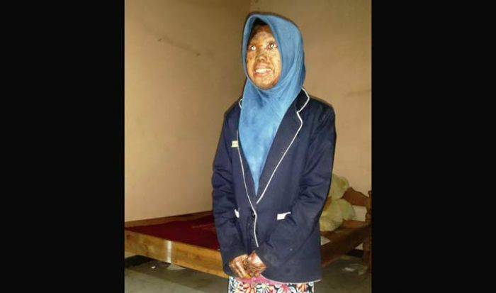 Maya si Bocah Berpenyakit Kulit Asal Nganjuk, Tak Surut Raih Prestasi Walau Tebar Aroma tak Sedap Maya si Bocah Berpenyakit Kulit Asal Nganjuk, Tak Surut Raih Prestasi Walau Tebar Aroma tak Sedap