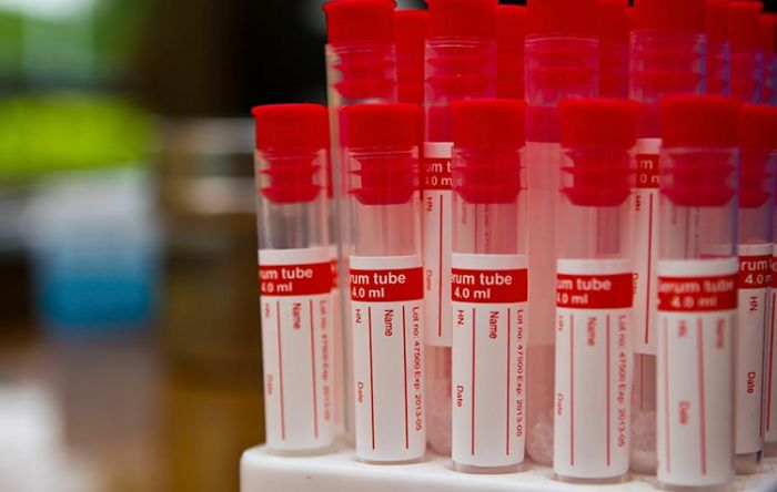 Nihil, Donor Plasma Darah Belum Direspons Pasien Sembuh Covid-19 Nihil, Donor Plasma Darah Belum Direspons Pasien Sembuh Covid-19