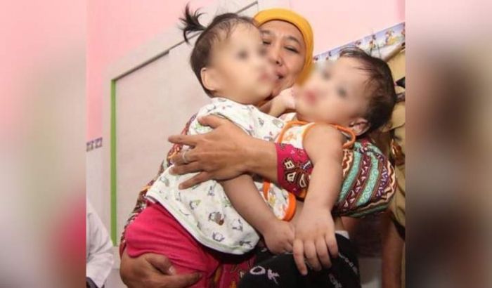 Gendong Kembar Siam Akila-Azila, Gubernur Khofifah: Insyaallah Sebentar Lagi, Dokter Siap Gendong Kembar Siam Akila-Azila, Gubernur Khofifah: Insyaallah Sebentar Lagi, Dokter Siap