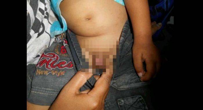 Warga Sonobekel Nganjuk Dihebohkan Bocah yang Dikhitan Jin Warga Sonobekel Nganjuk Dihebohkan Bocah yang Dikhitan Jin