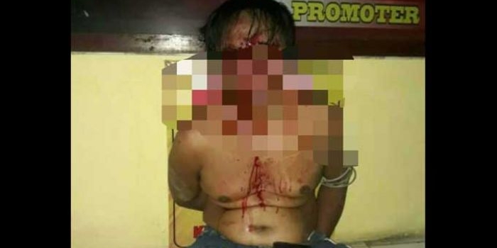 Tersangka dalam keadaan babak belur diamankan di Mapolres Pamekasan.