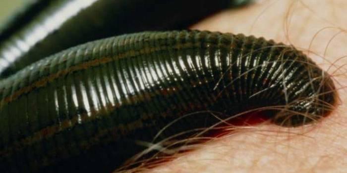 ?Liverani meyakini lintah berasal dari Vietnam atau Kamboja. Foto: repro bbc