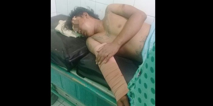 Pelaku saat menjalani perawatan usai dimassa.