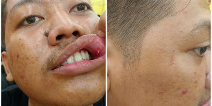kasus-dugaan-penganiayaan-jurnalis-beritajatim-oleh-polisi-jalan-di-tempat-kaj-tegaskan-hal-ini