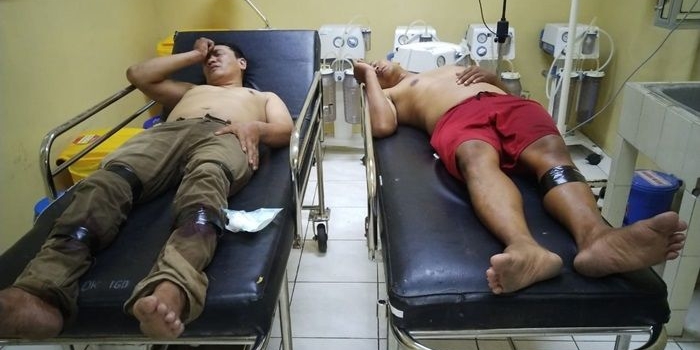 Kedua pelaku penjambretan saat berada di rumah sakit.