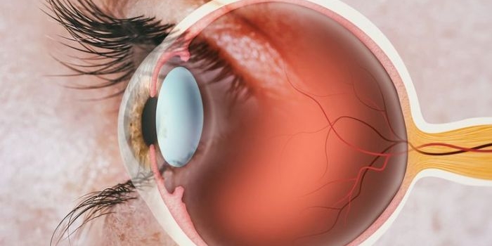 Apakah Diabetes dapat Menyebabkan Kebutaan? Simak Penjelasannya. Foto: Ist