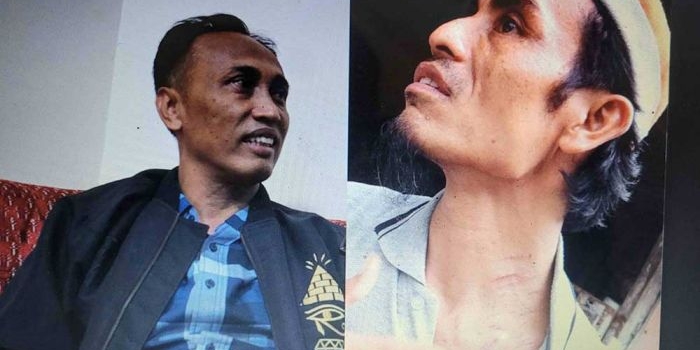 kepala-pasar-kolpajung-bantah-aniaya-korban-tunjukkan-luka-bekas-cakar