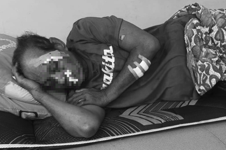 Korban usai mendapat perawatan akibat luka yang dialami atas penganiayaan