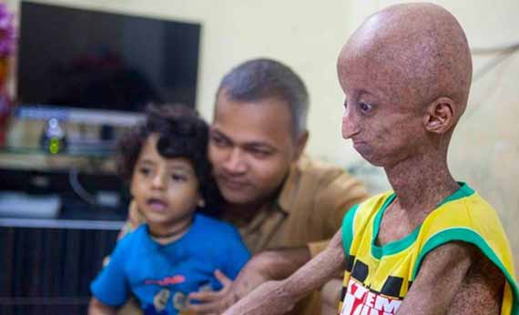 Kondisi Nihal Bitla yang memprihatinkan.
