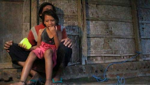 Kondisi Ida yang terikat kakinya selama ditinggal orang tuanya bekerja di sawah.