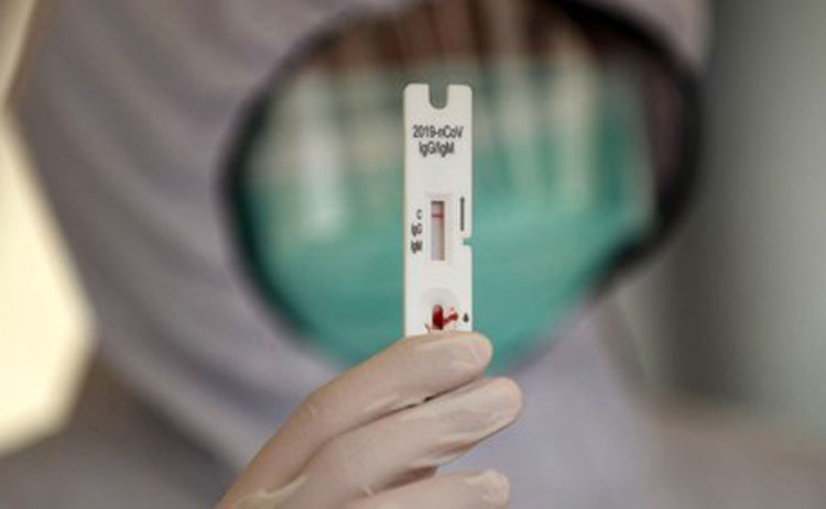 Ilustrasi rapid test.