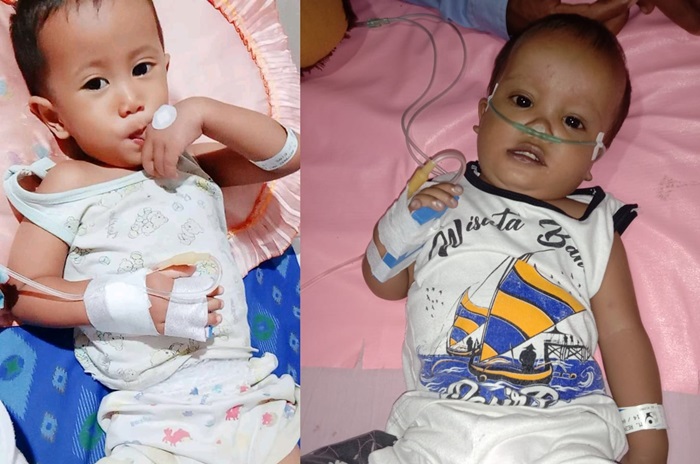 Kakak beradik yang mengalami kelainan jantung perlu uluran tangan dermawan.