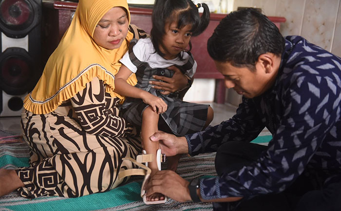 Wali Kota Kediri, Abdullah Abu Bakar, saat memakaikan sepatu ankle foot orthosis (AFO) di kaki Erika Adinia Putri. Foto: Ist