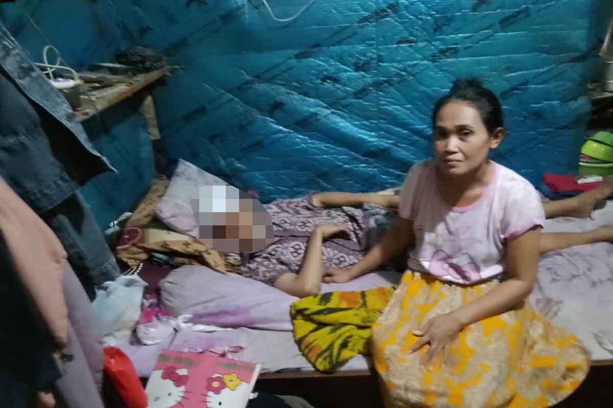 Korban dengan kondisi masih diperban dan terbaring di tempat tidurnya setelah menjadi korban pengeroyokan di dekat SPBU depan Puri Surya Jaya, Gedangan.
