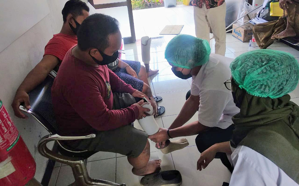 Proses pemasangan kaki palsu bagi 6 disabilitas dari Kabupaten Pamekasan.