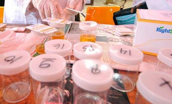 Urine milik sopir bus hendak dilakukan tes. 